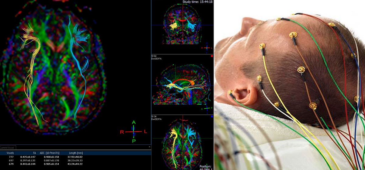 https://mybook.grupocintramedica.pt/wp-content/uploads/2022/04/EEG-electroencefalografia.jpg.crdownload.jpg