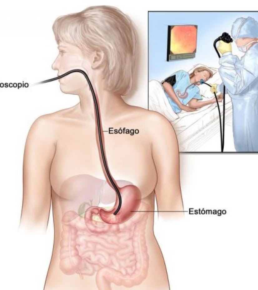 https://mybook.grupocintramedica.pt/wp-content/uploads/2022/04/Endoscopia-Digestiva-Alta-2-1.jpg